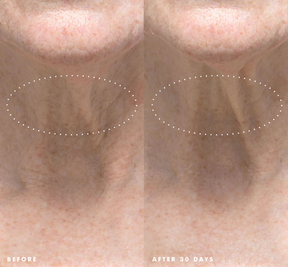 NECKS-LEVEL SMOOTH™ ULTRA-SMOOTHING TRIPLE EFFECT NECK CREAM